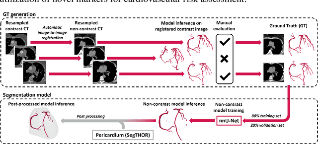 Figure 3 for Coronary artery segmentation in non-contrast calcium scoring CT images using deep learning