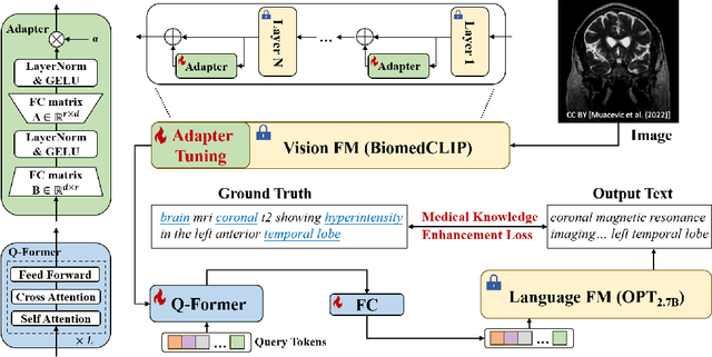 Figure 1 for Improving Medical Report Generation with Adapter Tuning and Knowledge Enhancement in Vision-Language Foundation Models