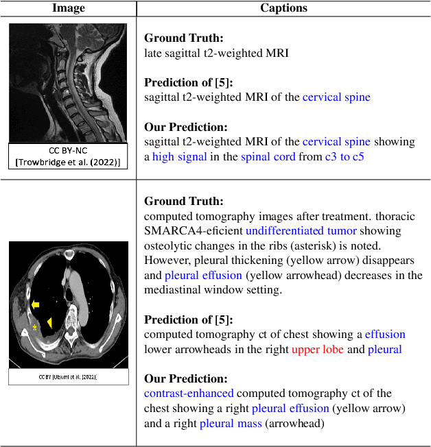 Figure 4 for Improving Medical Report Generation with Adapter Tuning and Knowledge Enhancement in Vision-Language Foundation Models