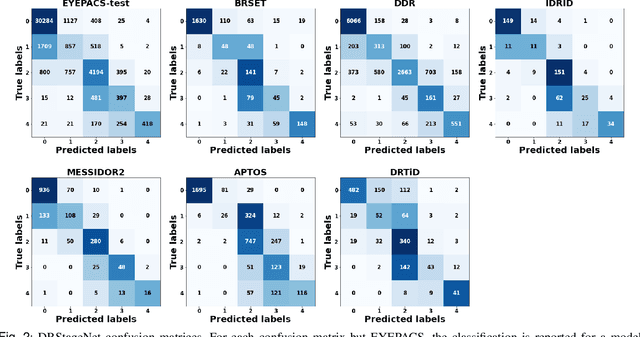 Figure 2 for DRStageNet: Deep Learning for Diabetic Retinopathy Staging from Fundus Images