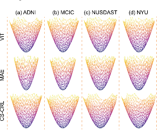 Figure 3 for Connectional-Style-Guided Contextual Representation Learning for Brain Disease Diagnosis