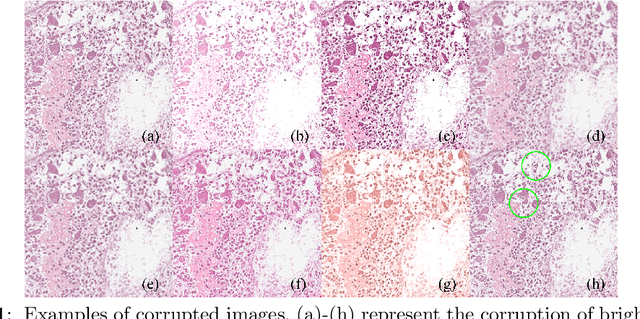 Figure 1 for Benchmarking PathCLIP for Pathology Image Analysis
