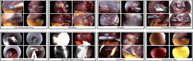 Figure 3 for CholecTrack20: A Dataset for Multi-Class Multiple Tool Tracking in Laparoscopic Surgery