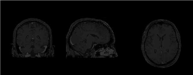 Figure 3 for Using U-Net Network for Efficient Brain Tumor Segmentation in MRI Images