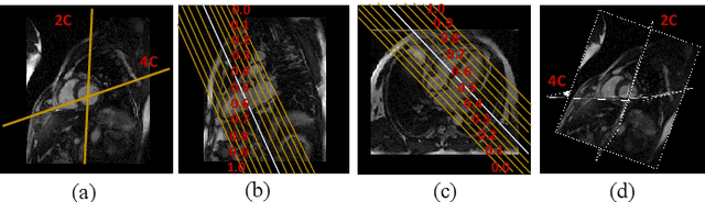 Figure 3 for Self-Supervised Learning for Medical Image Data with Anatomy-Oriented Imaging Planes