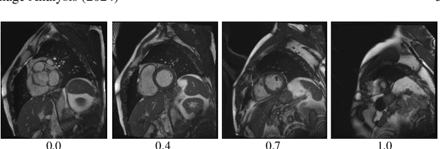 Figure 4 for Self-Supervised Learning for Medical Image Data with Anatomy-Oriented Imaging Planes