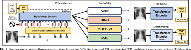 Figure 1 for Zero-Shot Pediatric Tuberculosis Detection in Chest X-Rays using Self-Supervised Learning