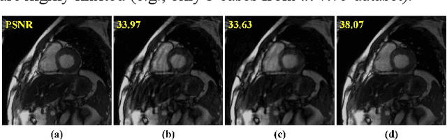 Figure 1 for Deep Separable Spatiotemporal Learning for Fast Dynamic Cardiac MRI