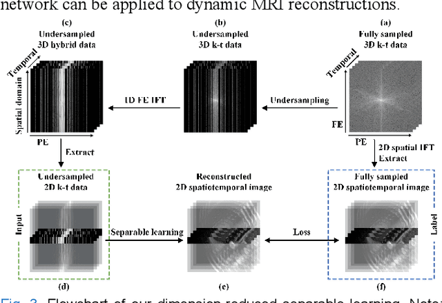 Figure 3 for Deep Separable Spatiotemporal Learning for Fast Dynamic Cardiac MRI