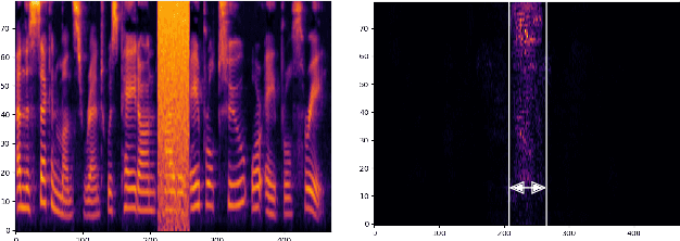 Figure 1 for Phoneme Discretized Saliency Maps for Explainable Detection of AI-Generated Voice