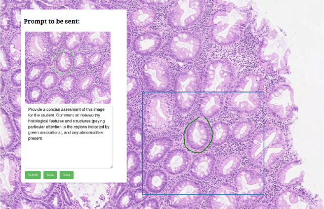 Figure 1 for TIAViz: A Browser-based Visualization Tool for Computational Pathology Models