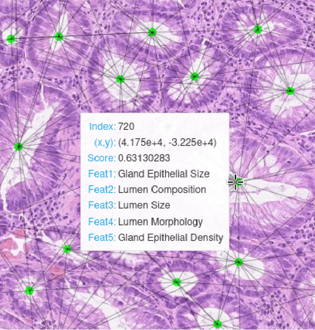Figure 3 for TIAViz: A Browser-based Visualization Tool for Computational Pathology Models