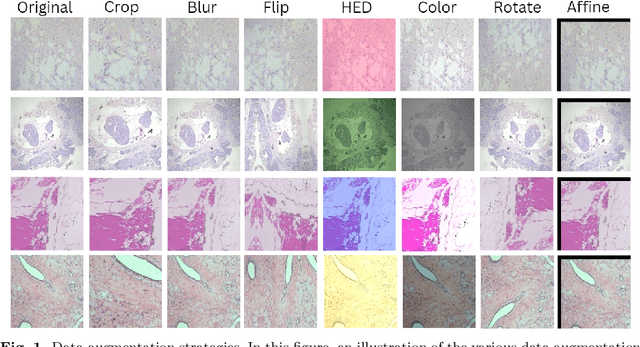 Figure 1 for Classification of Breast Cancer Histopathology Images using a Modified Supervised Contrastive Learning Method
