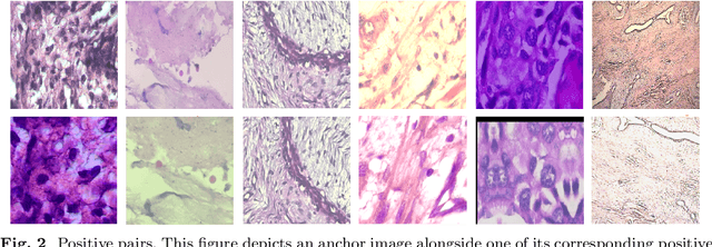 Figure 3 for Classification of Breast Cancer Histopathology Images using a Modified Supervised Contrastive Learning Method