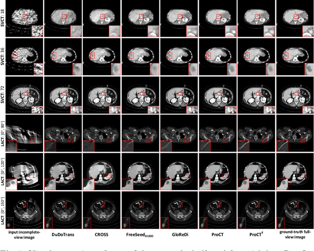 Figure 4 for Universal Incomplete-View CT Reconstruction with Prompted Contextual Transformer