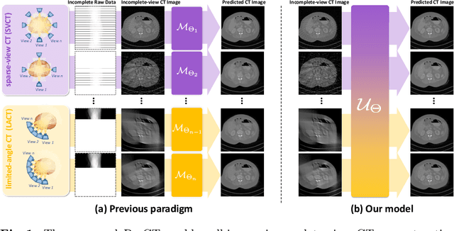 Figure 1 for Universal Incomplete-View CT Reconstruction with Prompted Contextual Transformer