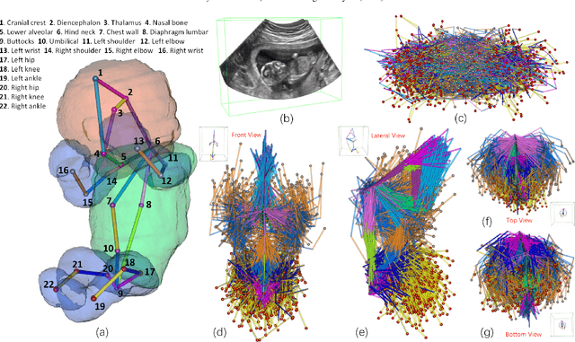 Figure 1 for FetusMapV2: Enhanced Fetal Pose Estimation in 3D Ultrasound