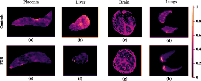 Figure 3 for PIPPI2021: An Approach to Automated Diagnosis and Texture Analysis of the Fetal Liver & Placenta in Fetal Growth Restriction