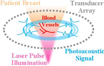 Figure 1 for Score-Based Diffusion Models for Photoacoustic Tomography Image Reconstruction