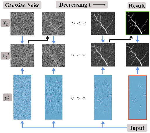 Figure 2 for Score-Based Diffusion Models for Photoacoustic Tomography Image Reconstruction