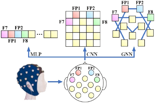 Figure 1 for GNN4EEG: A Benchmark and Toolkit for Electroencephalography Classification with Graph Neural Network