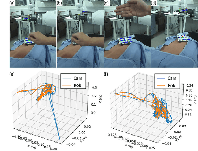 Figure 4 for Semi-Autonomous Laparoscopic Robot Docking with Learned Hand-Eye Information Fusion