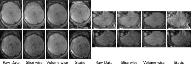 Figure 4 for HAITCH: A Framework for Distortion and Motion Correction in Fetal Multi-Shell Diffusion-Weighted MRI