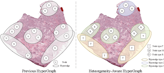 Figure 1 for Multi-Scale Heterogeneity-Aware Hypergraph Representation for Histopathology Whole Slide Images