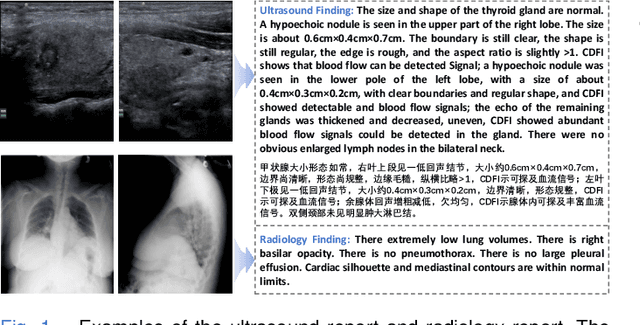 Figure 1 for Ultrasound Report Generation with Cross-Modality Feature Alignment via Unsupervised Guidance