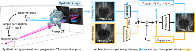 Figure 2 for Intraoperative 2D/3D Image Registration via Differentiable X-ray Rendering