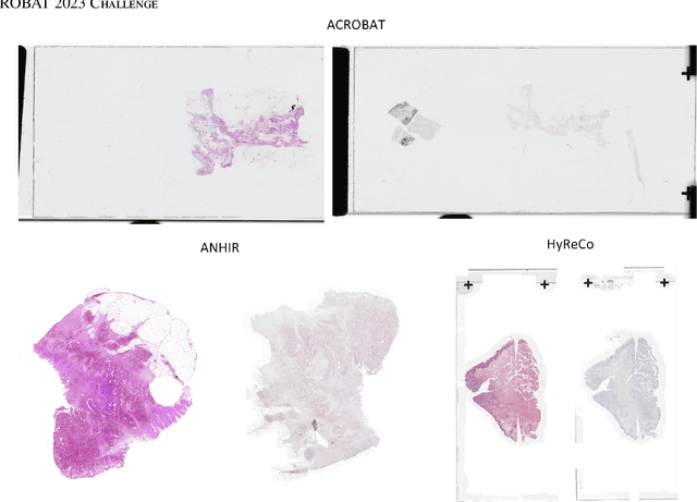 Figure 1 for RegWSI: Whole Slide Image Registration using Combined Deep Feature- and Intensity-Based Methods: Winner of the ACROBAT 2023 Challenge