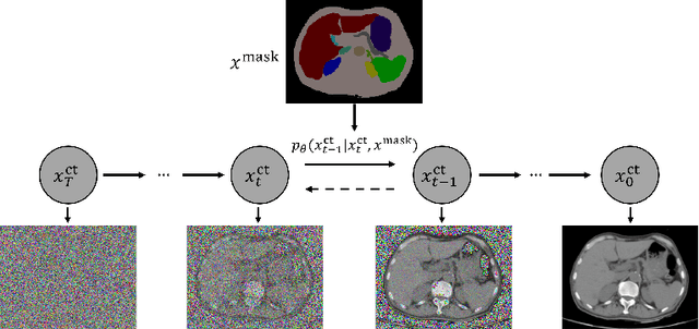 Figure 1 for Semantic Image Synthesis for Abdominal CT