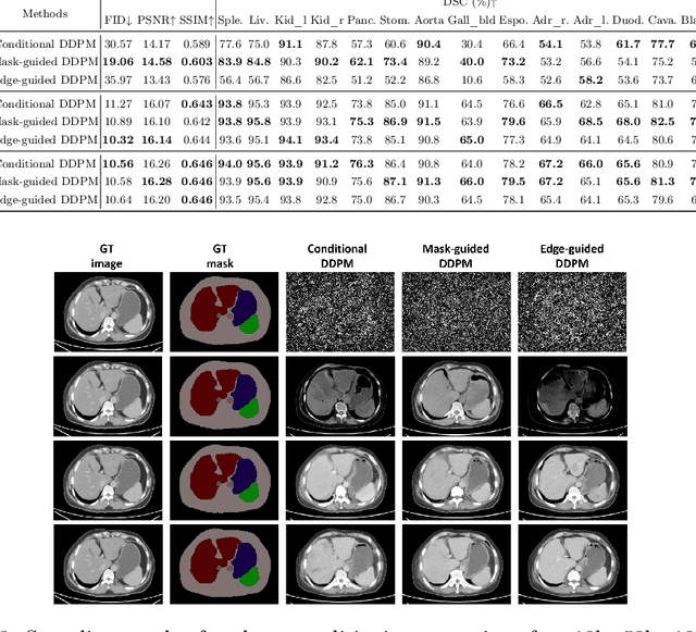 Figure 4 for Semantic Image Synthesis for Abdominal CT