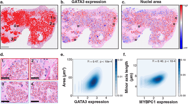 Figure 3 for HEST-1k: A Dataset for Spatial Transcriptomics and Histology Image Analysis