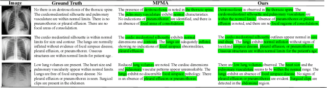 Figure 4 for UniDCP: Unifying Multiple Medical Vision-language Tasks via Dynamic Cross-modal Learnable Prompts