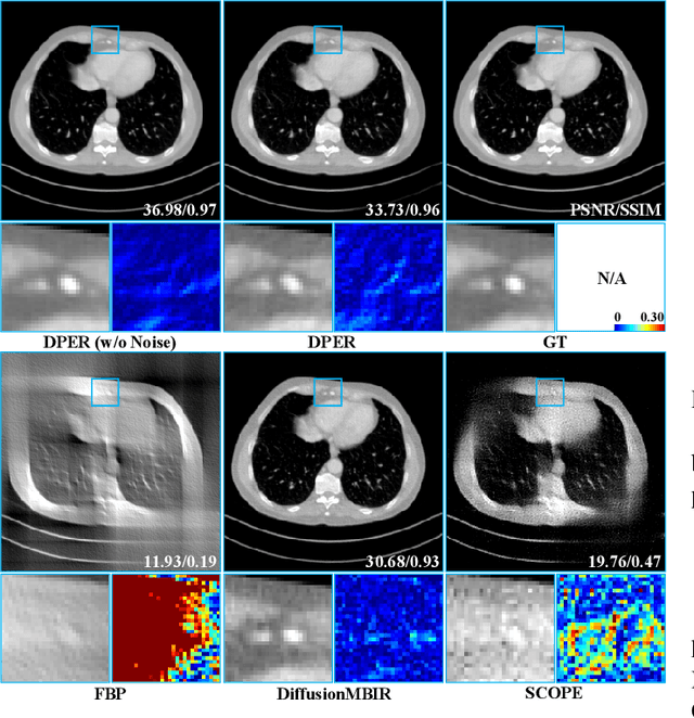 Figure 2 for DPER: Diffusion Prior Driven Neural Representation for Limited Angle and Sparse View CT Reconstruction