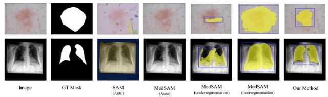 Figure 1 for Auto-Generating Weak Labels for Real & Synthetic Data to Improve Label-Scarce Medical Image Segmentation