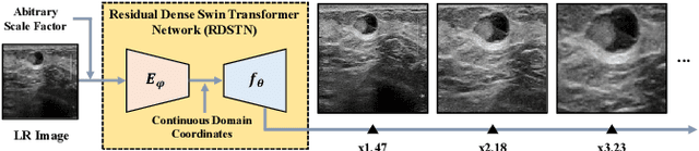 Figure 1 for Residual Dense Swin Transformer for Continuous Depth-Independent Ultrasound Imaging