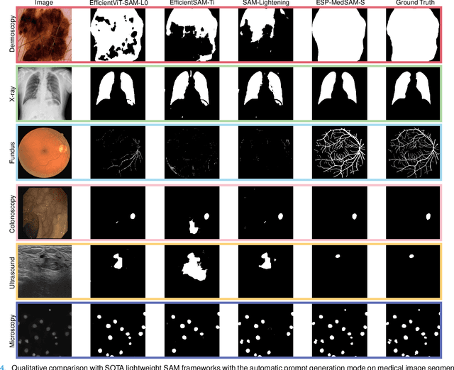 Figure 4 for ESP-MedSAM: Efficient Self-Prompting SAM for Universal Domain-Generalized Medical Image Segmentation