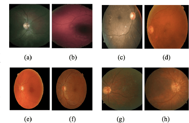 Figure 2 for Learning Self-Supervised Representations for Label Efficient Cross-Domain Knowledge Transfer on Diabetic Retinopathy Fundus Images