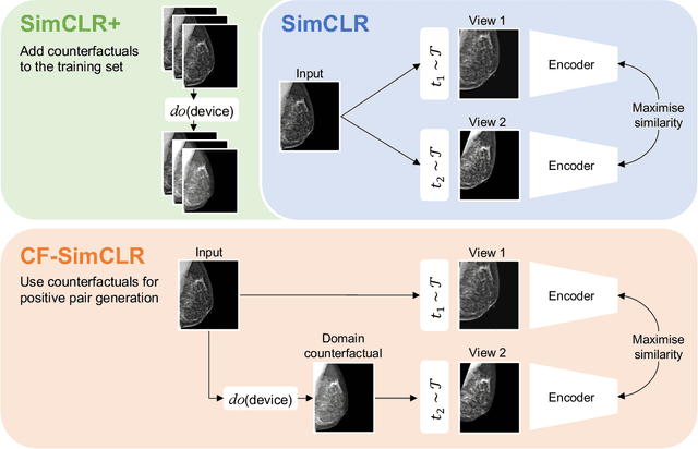 Figure 1 for Counterfactual contrastive learning: robust representations via causal image synthesis