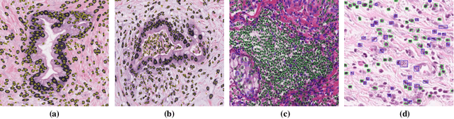 Figure 4 for A Weakly Supervised Segmentation Network Embedding Cross-scale Attention Guidance and Noise-sensitive Constraint for Detecting Tertiary Lymphoid Structures of Pancreatic Tumors