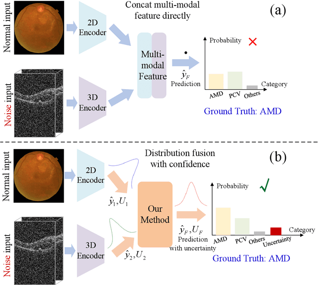 Figure 1 for Confidence-aware multi-modality learning for eye disease screening