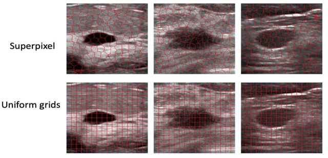 Figure 1 for Dual-Channel Reliable Breast Ultrasound Image Classification Based on Explainable Attribution and Uncertainty Quantification