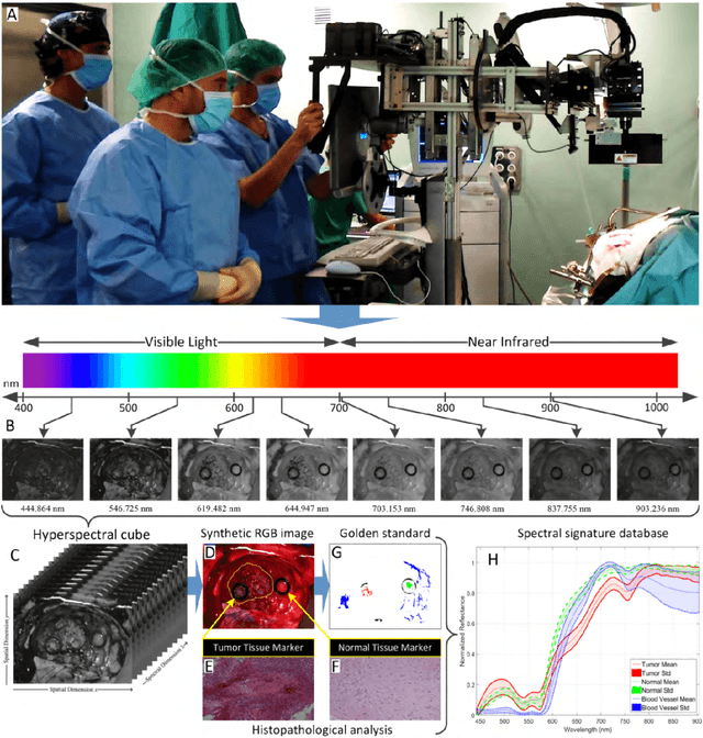 Figure 1 for In-Vivo Hyperspectral Human Brain Image Database for Brain Cancer Detection