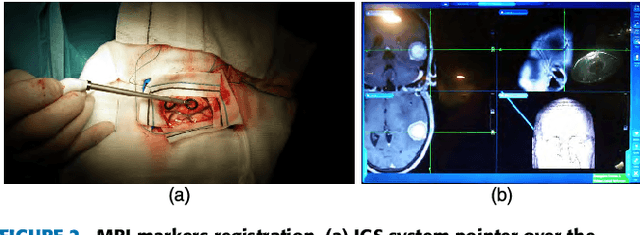 Figure 3 for In-Vivo Hyperspectral Human Brain Image Database for Brain Cancer Detection