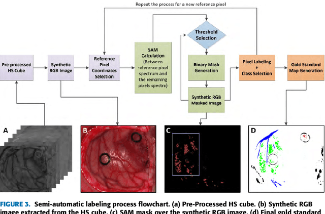 Figure 4 for In-Vivo Hyperspectral Human Brain Image Database for Brain Cancer Detection