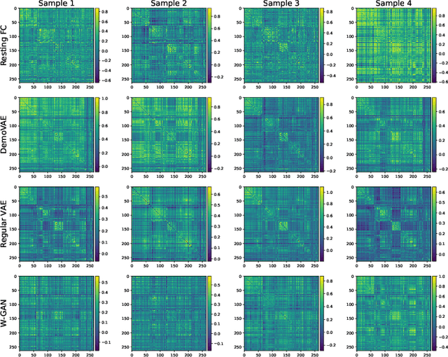 Figure 3 for A Demographic-Conditioned Variational Autoencoder for fMRI Distribution Sampling and Removal of Confounds