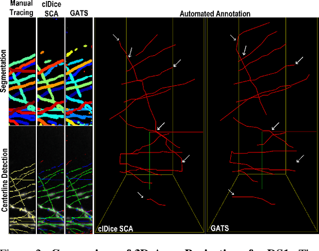 Figure 4 for Improved Topological Preservation in 3D Axon Segmentation and Centerline Detection using Geometric Assessment-driven Topological Smoothing (GATS)