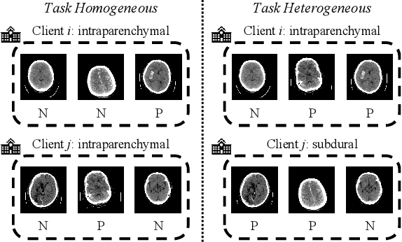 Figure 1 for FedMLP: Federated Multi-Label Medical Image Classification under Task Heterogeneity